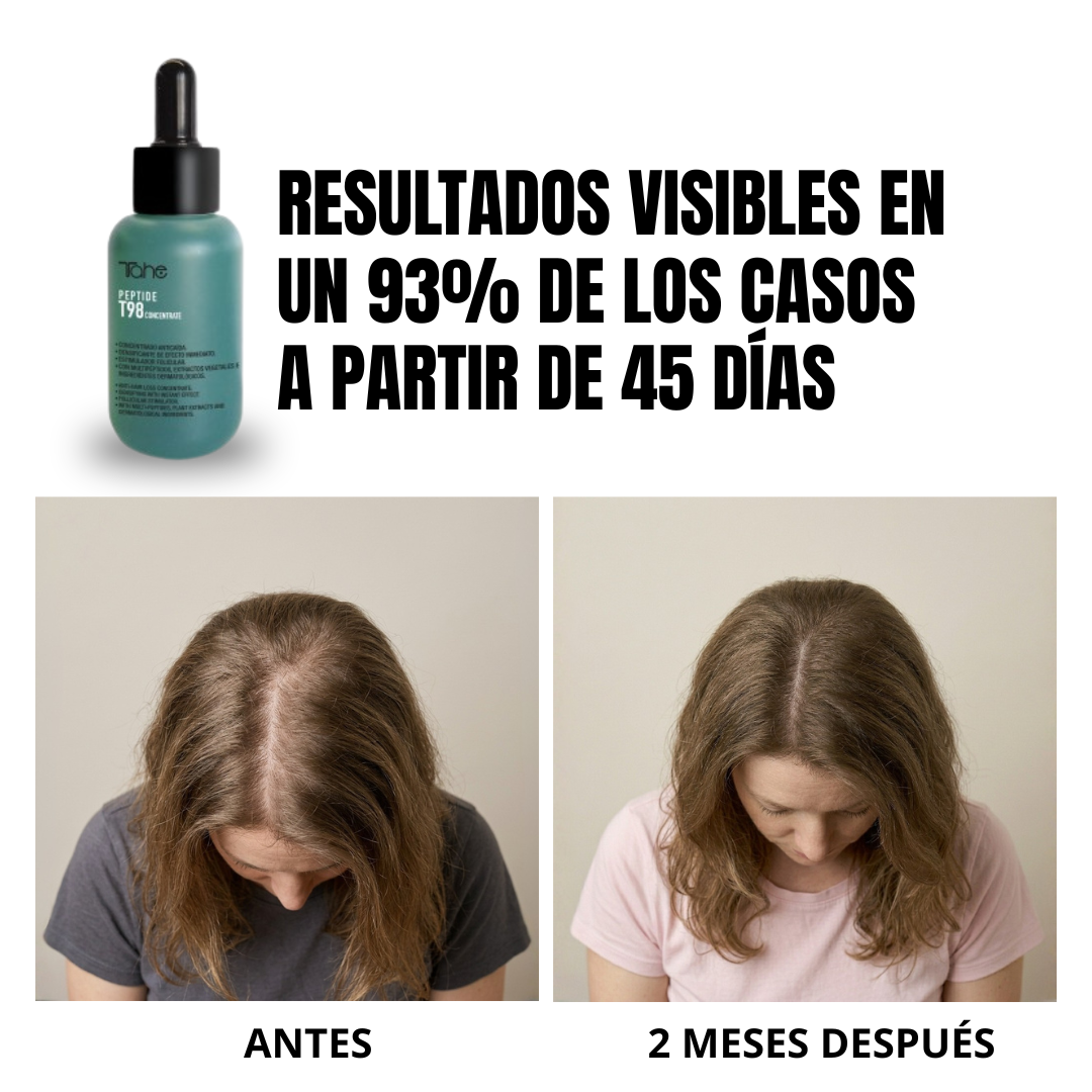 Tratamiento Anticaída Peptide T98: Concentrado 50ml + Champú 300ml