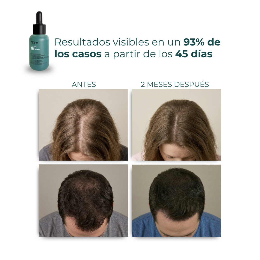 Tratamiento Anticaída Peptide T98: Concentrado 50ml + Champú 300ml
