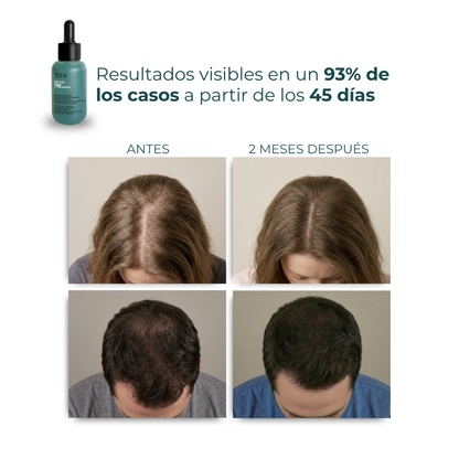 Tratamiento Anticaída Peptide T98: Concentrado 50ml + Champú 300ml