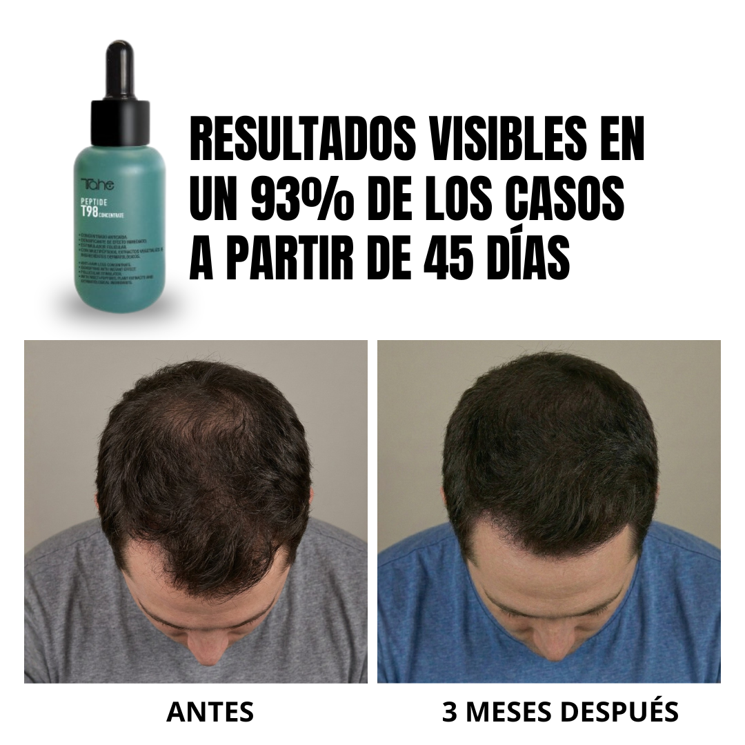 Tratamiento Anticaída Peptide T98: Concentrado 50ml + Champú 300ml
