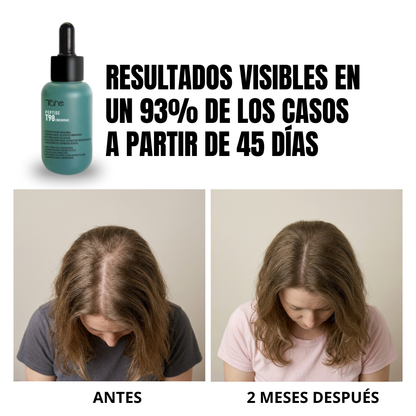 Tratamiento Anticaída Peptide T98: Concentrado 50ml + Champú 300ml